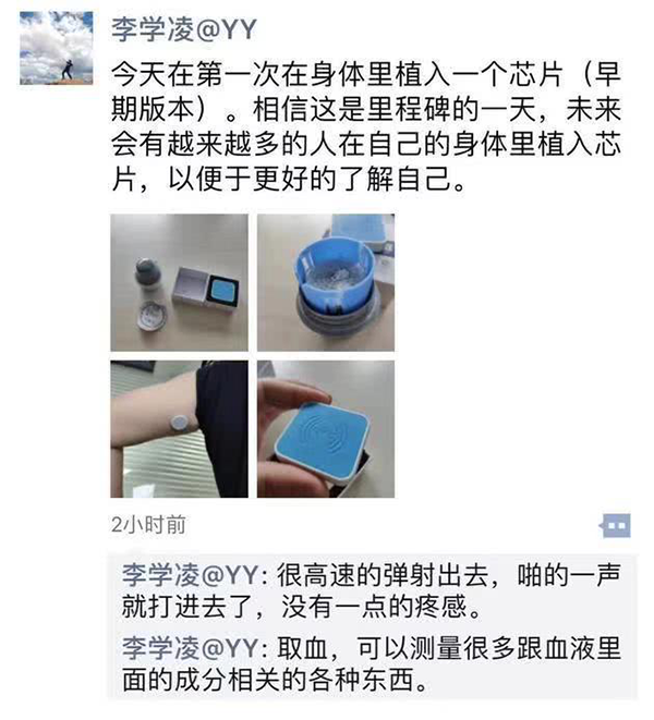 AI医疗目前首要任务是解决医疗难题,而不是鼓吹噱头-锋巢网